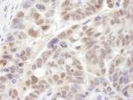 PSMC1 Antibody in Immunohistochemistry (Paraffin) (IHC (P))