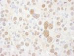 PSMC2 Antibody in Immunohistochemistry (Paraffin) (IHC (P))