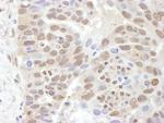 PSMC2 Antibody in Immunohistochemistry (Paraffin) (IHC (P))