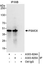 PSMC6 Antibody in Immunoprecipitation (IP)