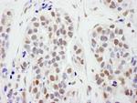 SMC1 Antibody in Immunohistochemistry (Paraffin) (IHC (P))