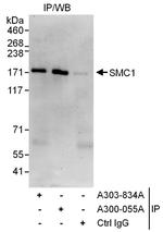 SMC1 Antibody in Immunoprecipitation (IP)