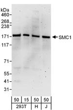 SMC1 Antibody in Western Blot (WB)