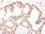 KAP-1 Antibody in Immunohistochemistry (Paraffin) (IHC (P))