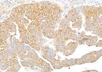 RPS3 Antibody in Immunohistochemistry (Paraffin) (IHC (P))