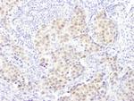 PSMB5 Antibody in Immunohistochemistry (Paraffin) (IHC (P))