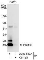 PSMB5 Antibody in Immunoprecipitation (IP)