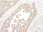 PSMC4 Antibody in Immunohistochemistry (Paraffin) (IHC (P))