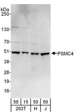 PSMC4 Antibody in Western Blot (WB)