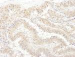 PSMC4 Antibody in Immunohistochemistry (Paraffin) (IHC (P))