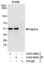 PSMC4 Antibody in Immunoprecipitation (IP)