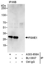 PSME1 Antibody in Immunoprecipitation (IP)