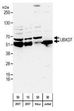 UBXD7 Antibody in Western Blot (WB)