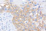 CD44 Antibody in Immunohistochemistry (Paraffin) (IHC (P))