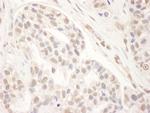 MED1 Antibody in Immunohistochemistry (Paraffin) (IHC (P))