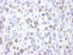 BRG1/SMARCA4 Antibody in Immunohistochemistry (Paraffin) (IHC (P))