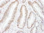 BRG1/SMARCA4 Antibody in Immunohistochemistry (Paraffin) (IHC (P))