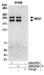 BRG1/SMARCA4 Antibody in Immunoprecipitation (IP)