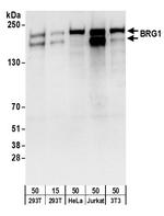 BRG1/SMARCA4 Antibody in Western Blot (WB)