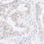 ADAR1 Antibody in Immunohistochemistry (Paraffin) (IHC (P))