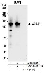 ADAR1 Antibody in Immunoprecipitation (IP)