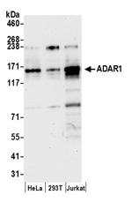 ADAR1 Antibody in Western Blot (WB)