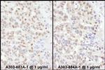 ADAR1 Antibody in Immunohistochemistry (Paraffin) (IHC (P))