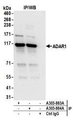 ADAR1 Antibody in Immunoprecipitation (IP)