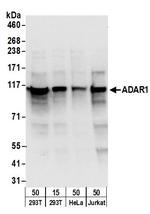 ADAR1 Antibody in Western Blot (WB)