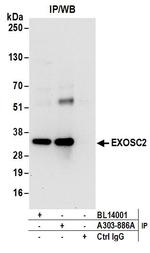 EXOSC2 Antibody in Immunoprecipitation (IP)