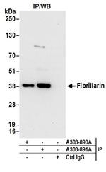 Fibrillarin Antibody in Immunoprecipitation (IP)