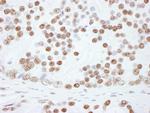 hnRNP-L Antibody in Immunohistochemistry (Paraffin) (IHC (P))