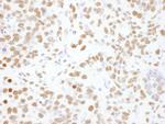 hnRNP-L Antibody in Immunohistochemistry (Paraffin) (IHC (P))