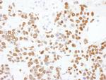 hnRNP-L Antibody in Immunohistochemistry (Paraffin) (IHC (P))