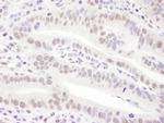 PRPF31 Antibody in Immunohistochemistry (Paraffin) (IHC (P))