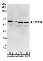 PRPF31 Antibody in Western Blot (WB)