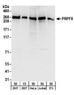 PRPF8 Antibody in Western Blot (WB)