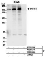 PRPF8 Antibody in Immunoprecipitation (IP)