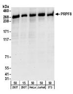 PRPF8 Antibody in Western Blot (WB)