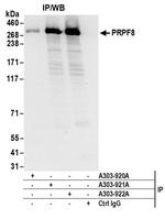 PRPF8 Antibody in Immunoprecipitation (IP)