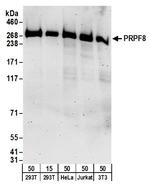 PRPF8 Antibody in Western Blot (WB)