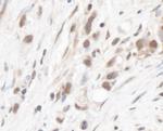 RPL5 Antibody in Immunohistochemistry (Paraffin) (IHC (P))