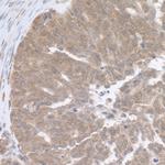 RPL5 Antibody in Immunohistochemistry (Paraffin) (IHC (P))