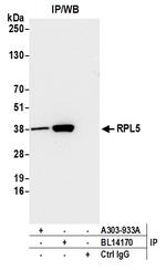 RPL5 Antibody in Immunoprecipitation (IP)