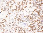 DBC1/p30 DBC Antibody in Immunohistochemistry (Paraffin) (IHC (P))