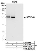 DBC1/p30 DBC Antibody in Immunoprecipitation (IP)