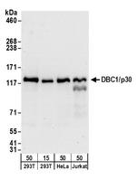 DBC1/p30 DBC Antibody in Western Blot (WB)