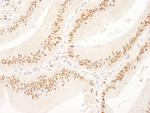 USP7 Antibody in Immunohistochemistry (Paraffin) (IHC (P))