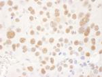 USP7 Antibody in Immunohistochemistry (Paraffin) (IHC (P))