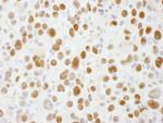 Sp1 Antibody in Immunohistochemistry (Paraffin) (IHC (P))